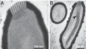 西伯利亚三万年前巨型病毒复活 阔口罐病毒(Pithovirus sibericum